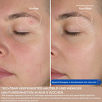 LED Complete Routine Set